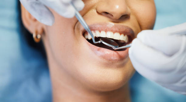 Best Emergency Dentist for Knocked-Out Tooth in Easton, MD